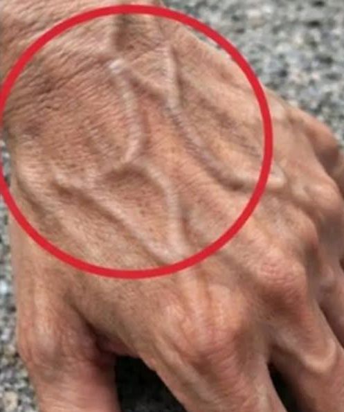 Visible Veins Under Skin