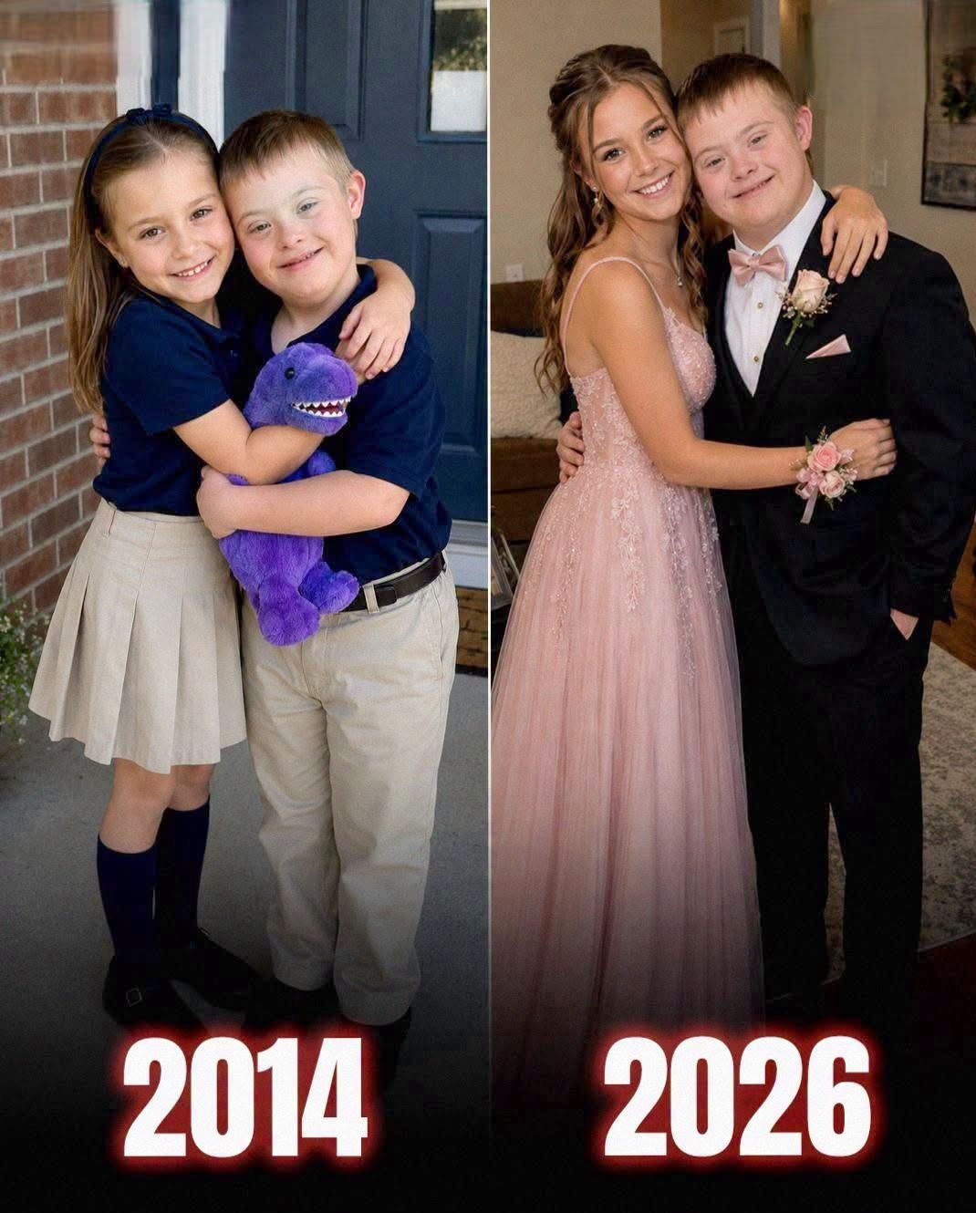 best friend with Down syndrome